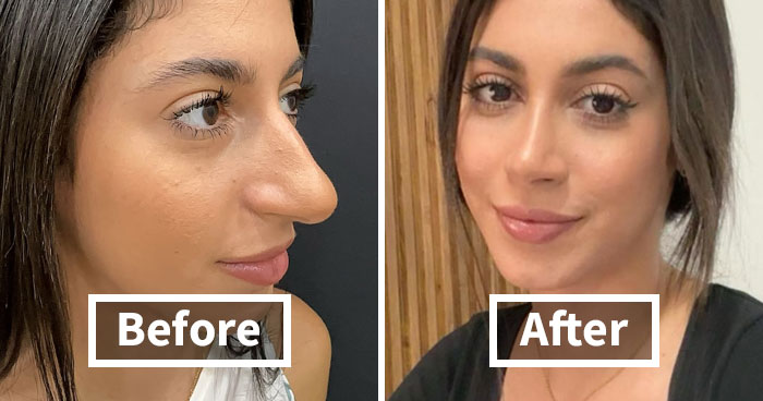 Wait Till You See These Wild Turkish Makeovers!