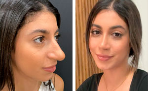 Wait Till You See These Wild Turkish Makeovers!