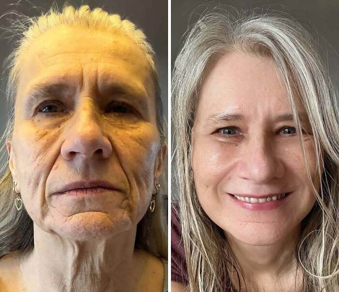 Wait Till You See These Wild Turkish Makeovers!