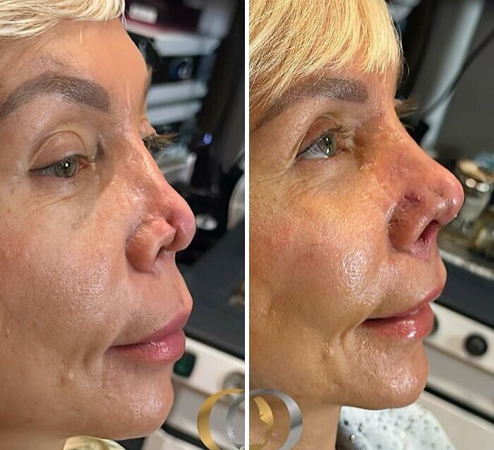 Wait Till You See These Wild Turkish Makeovers!