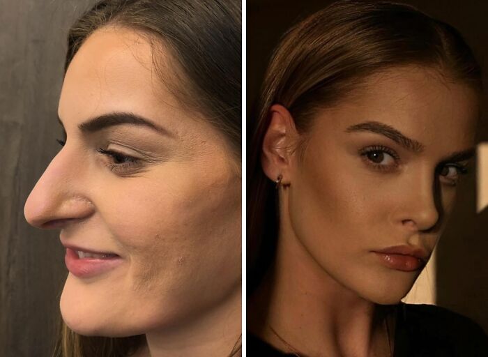 Wait Till You See These Wild Turkish Makeovers!