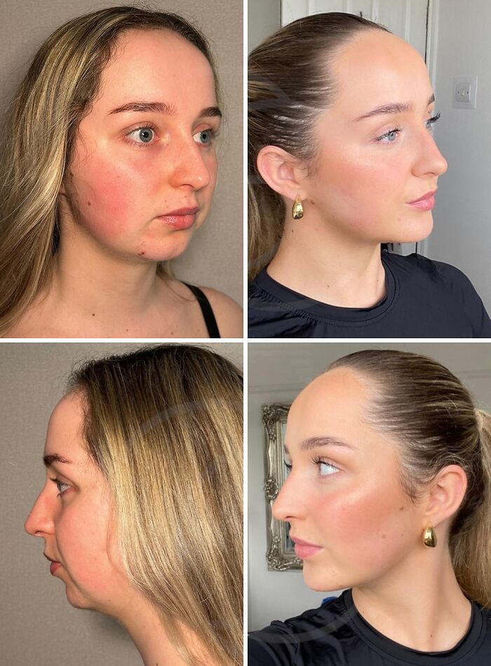 Wait Till You See These Wild Turkish Makeovers!