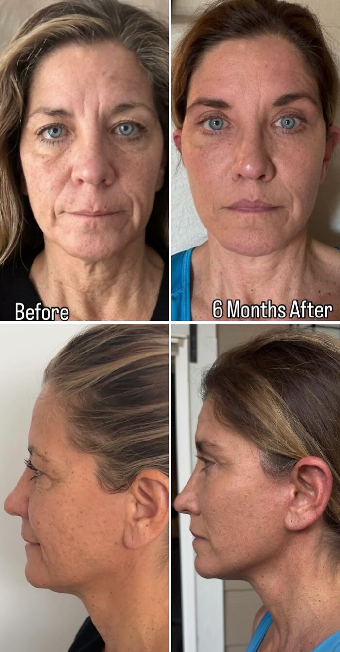 Wait Till You See These Wild Turkish Makeovers!