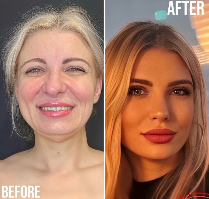 Wait Till You See These Wild Turkish Makeovers!
