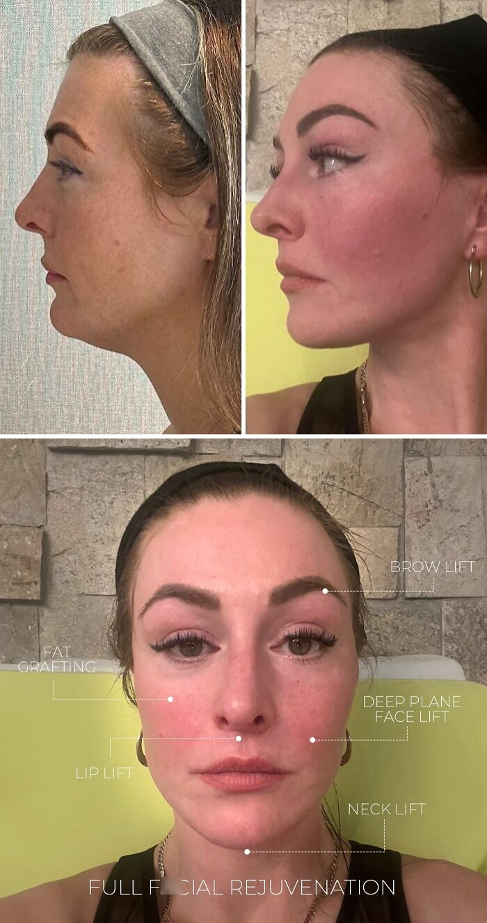 Wait Till You See These Wild Turkish Makeovers!