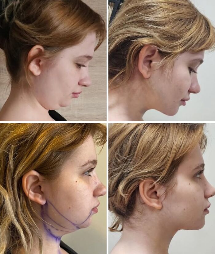 Wait Till You See These Wild Turkish Makeovers!