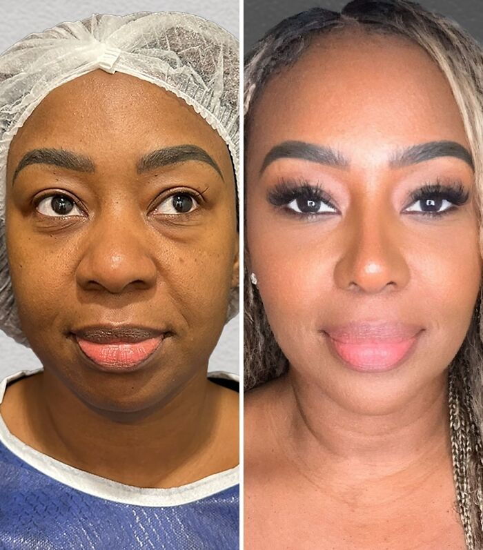 Wait Till You See These Wild Turkish Makeovers!