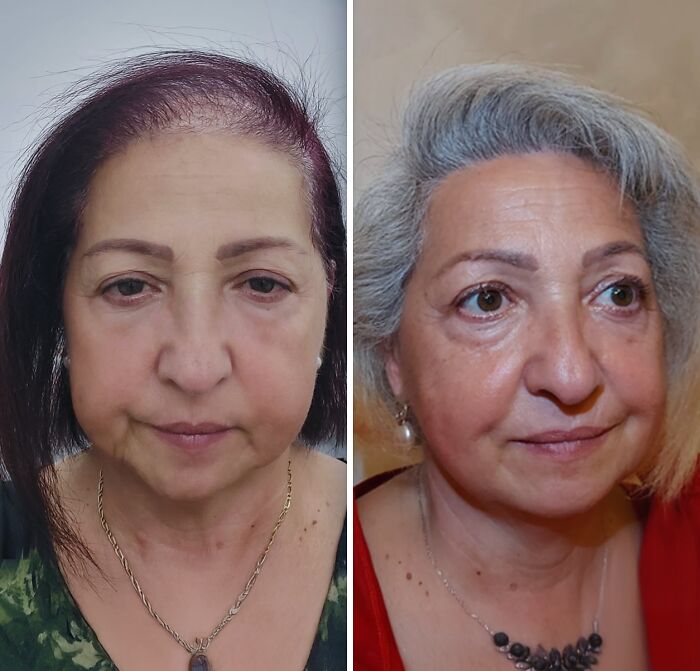 Wait Till You See These Wild Turkish Makeovers!