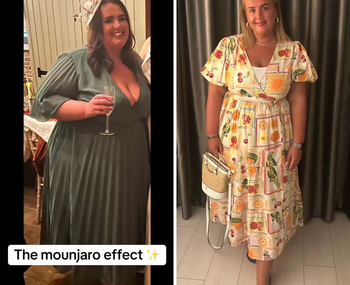 Check Out These Wild Mounjaro Weight Loss Transformations!
