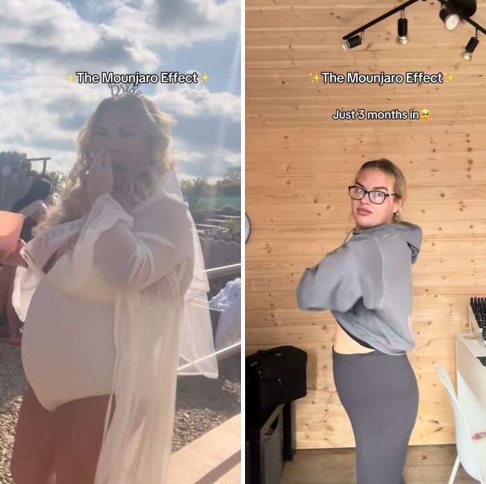 Check Out These Wild Mounjaro Weight Loss Transformations!