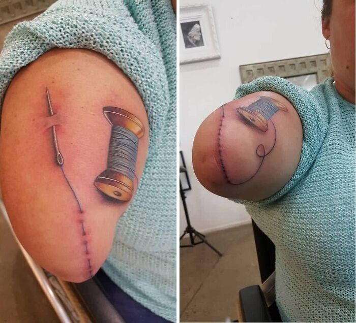 Arm Stump Tattoo Drama? We Got You Covered!