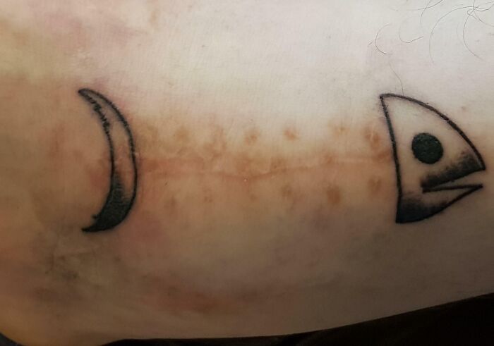 Scar Tattoo Turned My Ankle Surgery Story Into Silliness