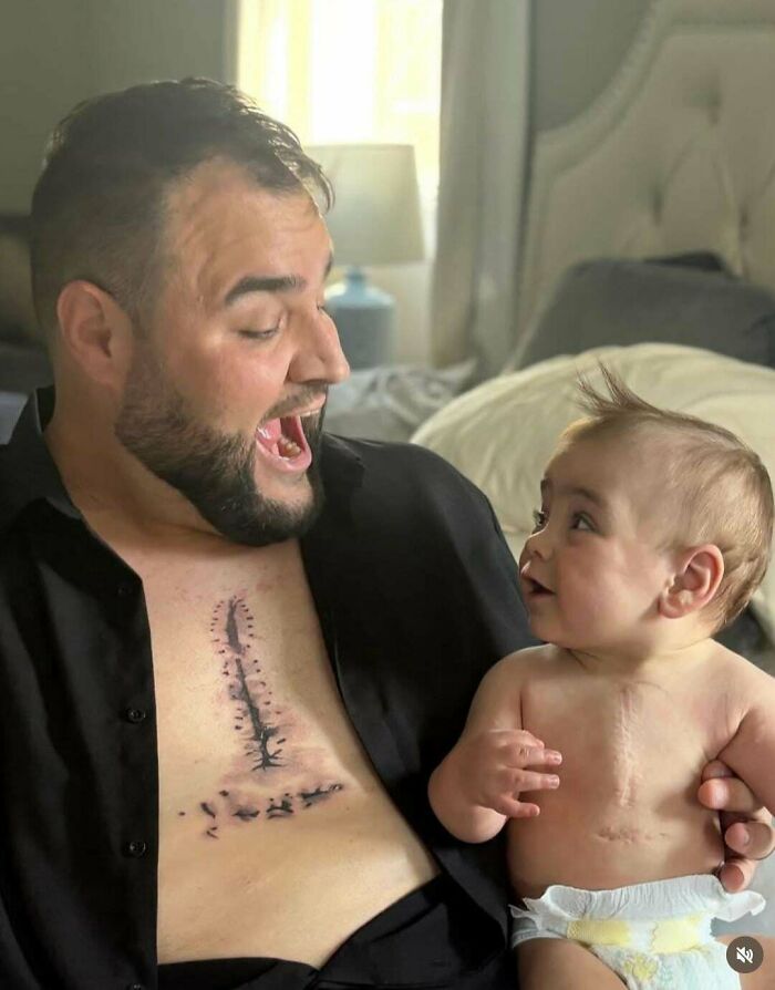 Dad’s Tattoo Matches Son’s Surgery Scar. Talk About Dad Goals!