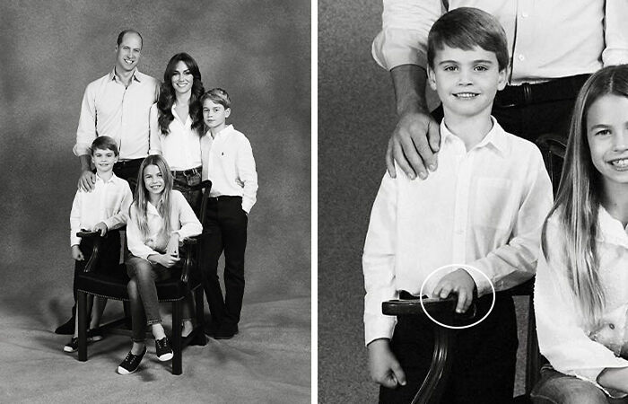 Prince Louis’ Missing Finger Mystery