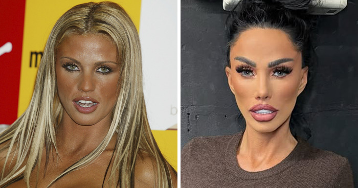 Katie Price: The Queen of ‘Too Much’?