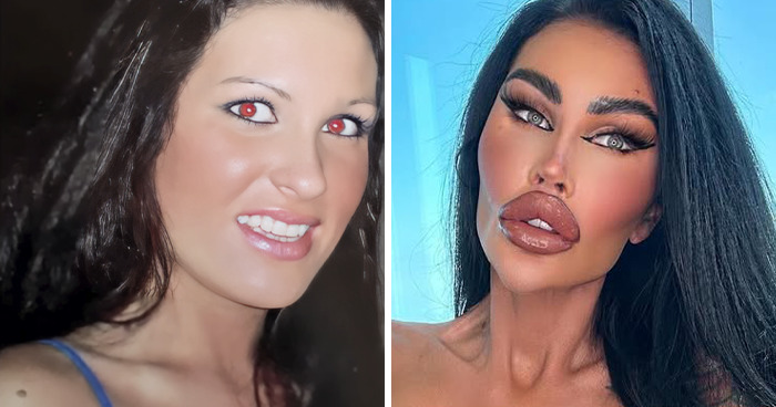 Tara Jayne: Plastic Surgery Queen or Scary Transformation?