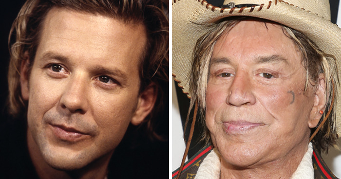 Mickey Rourke: From Heartthrob to Plastic Drama