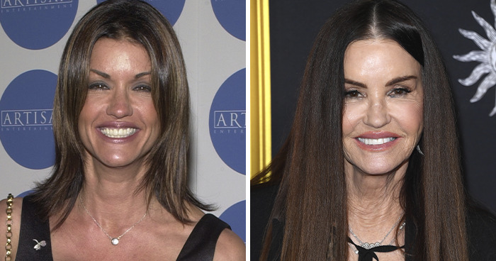 Janice Dickinson: Supermodel’s Surgery Saga