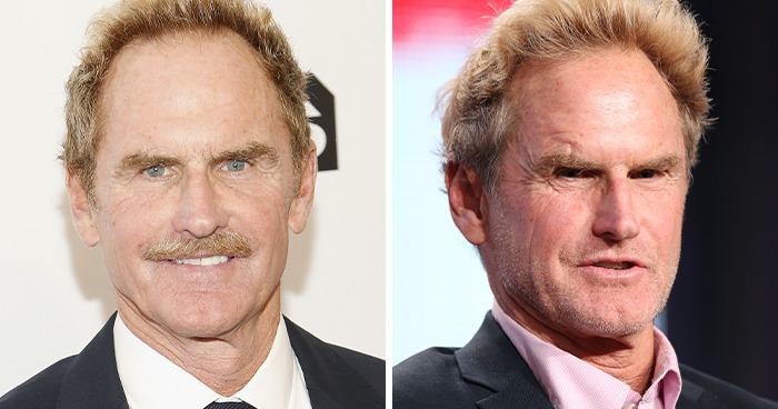 Jere Burns: Botox Overload Alert!