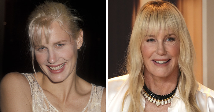 Daryl Hannah: When Fillers Go Sideways
