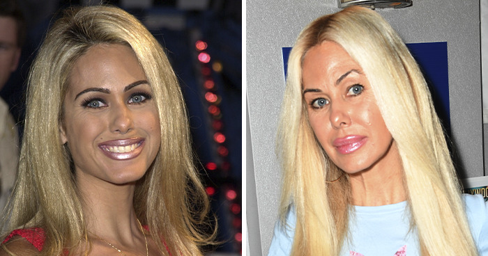 Shauna Sand: When Surgery Backfires