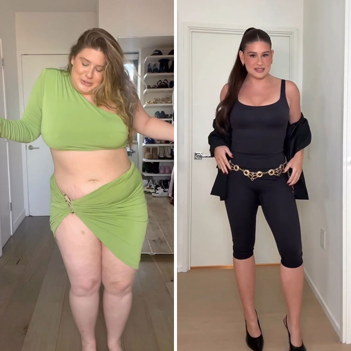 Remi Bader and the Weight-Loss Surgery Secret No One Saw Coming