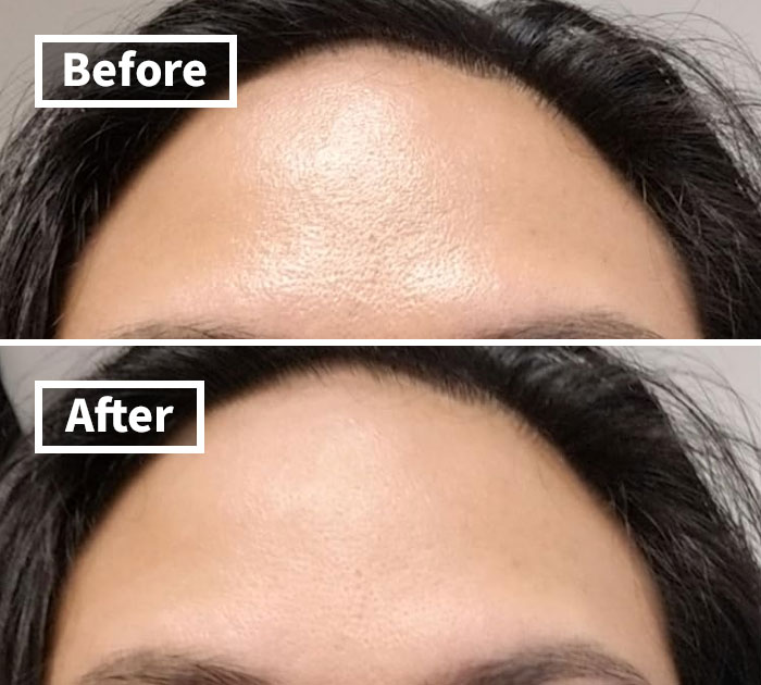 Zap Shine Away With Revlon's Volcanic Face Roller: Your Shine-Busting Sidekick