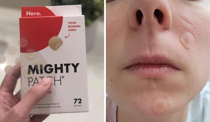Can't Stop Popping Zits? Let Mighty Patch Do The Work While You Sleep