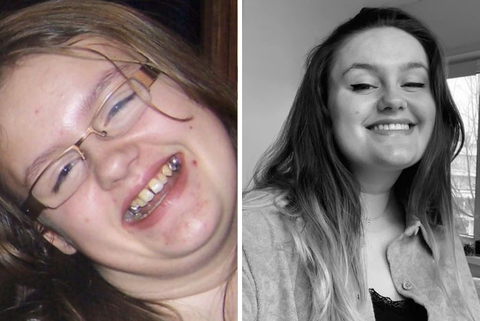 Wait, People Used This Song for Crazy Before-And-After Pics?