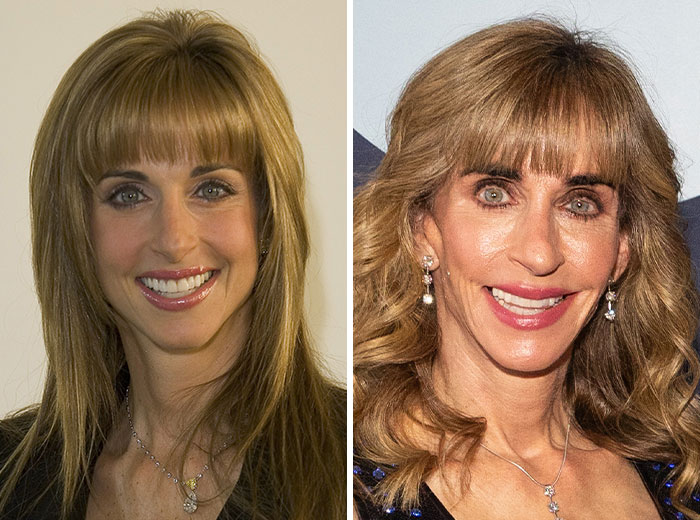 Susan Dell: The Philanthropist With a Face Tight Like a Drum