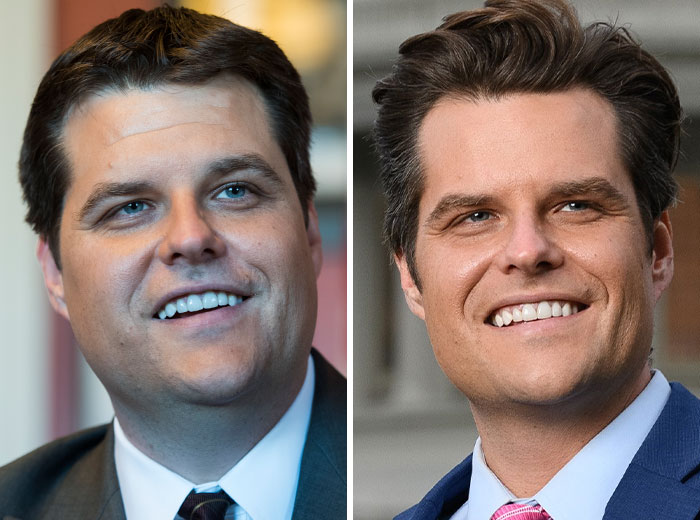 Matt Gaetz: Botox Fail or Bold Look? You Decide!