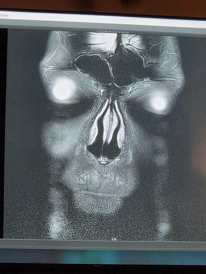 My MRI Scan Results Look Kinda Creepy