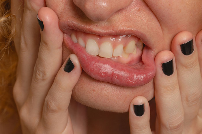 Wild Things Teens Did to Their Bodies to Fit In (And Wow, Just Wow)