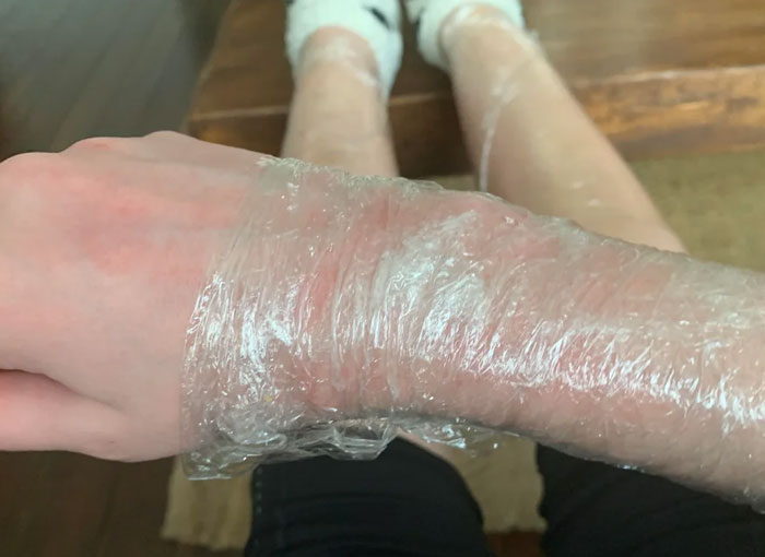 Wild Things Teens Did to Their Bodies to Fit In (And Wow, Just Wow)