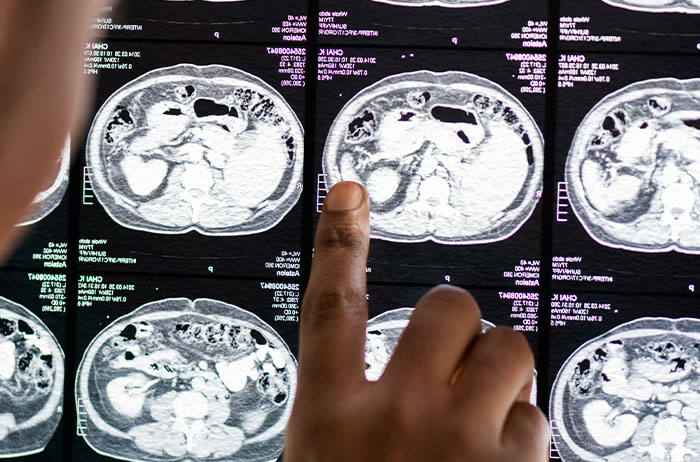 Wait, People Actually Know These Scary Facts and Wish They Could Unsee Them?