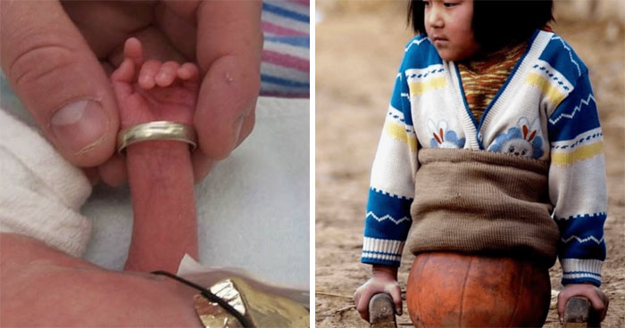 Whoa! These 57 Medical Pics Are Straight-Up Wild