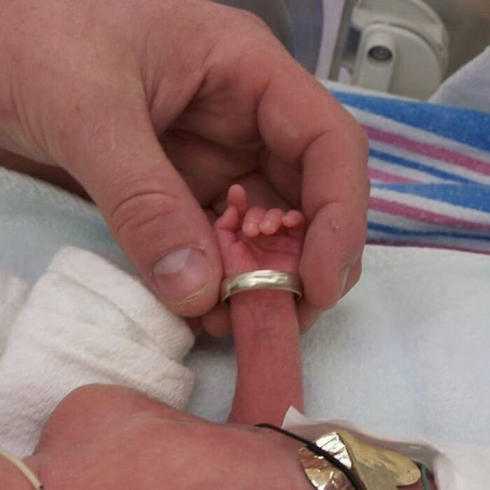 Tiny Preemie Baby So Small Dad’s Ring Doubled As a Bracelet!