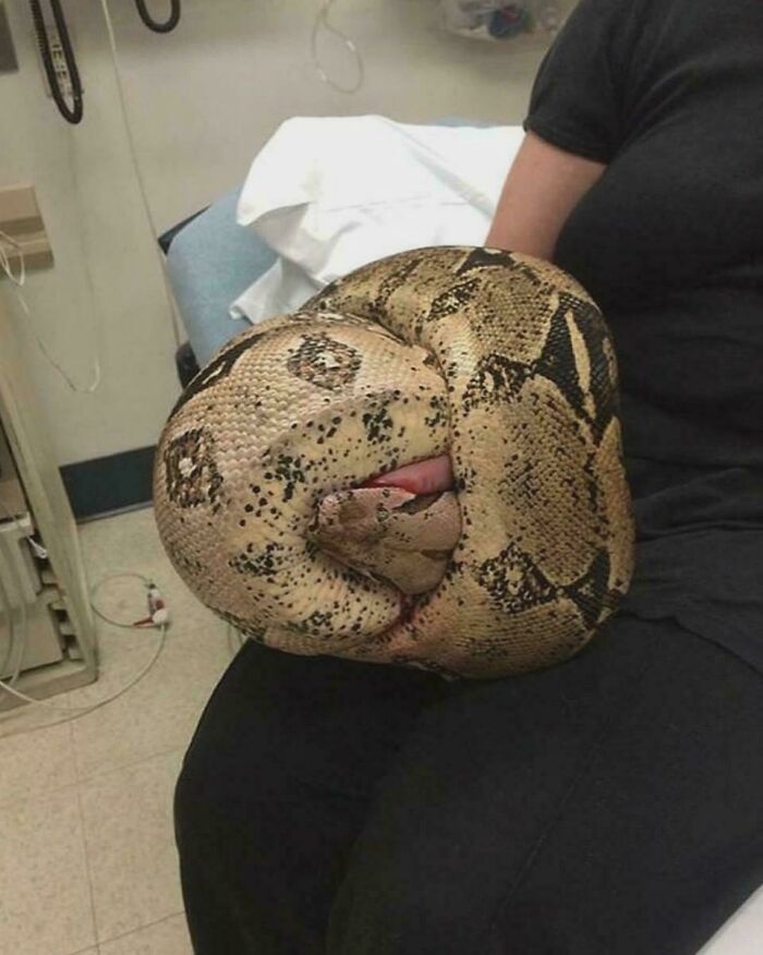 Emergency Room Visitor: Boa Constrictor Says Hello