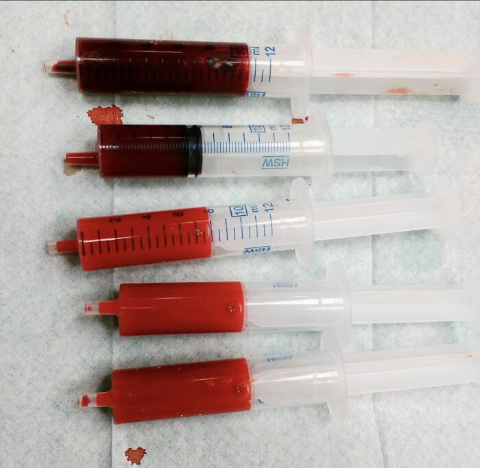 Bright Arterial Blood vs. Dark Venous Blood: Nature’s Color Code