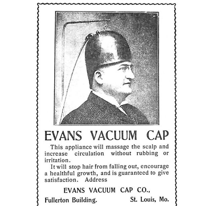Evans Vacuum Cap: The ‘Science’ of Hair Growth (Until the Law Said Nope)