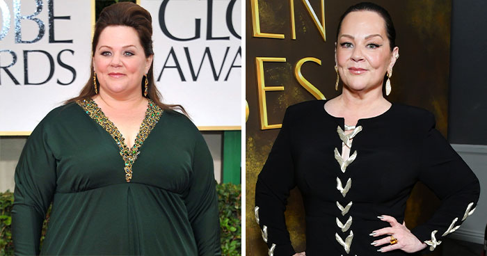 Wait, Did They Really Get That Done? Golden Globes 2026 Glow-Up Gossip!