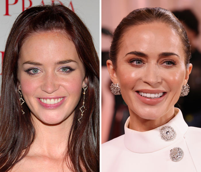 Emily Blunt’s Mysterious Face Changes