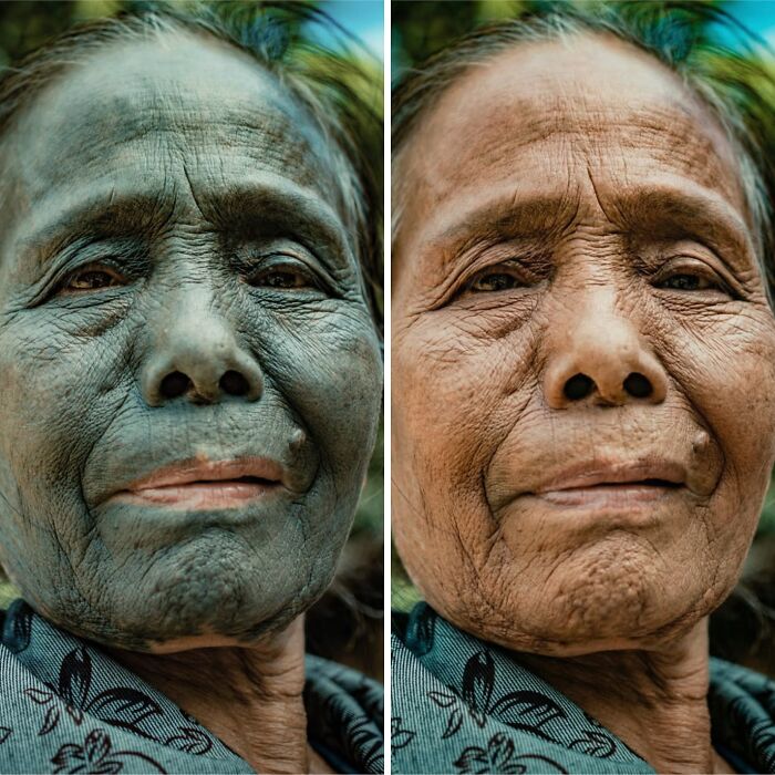 Oops, What Happens When You Zap Tribal Tattoos Away?