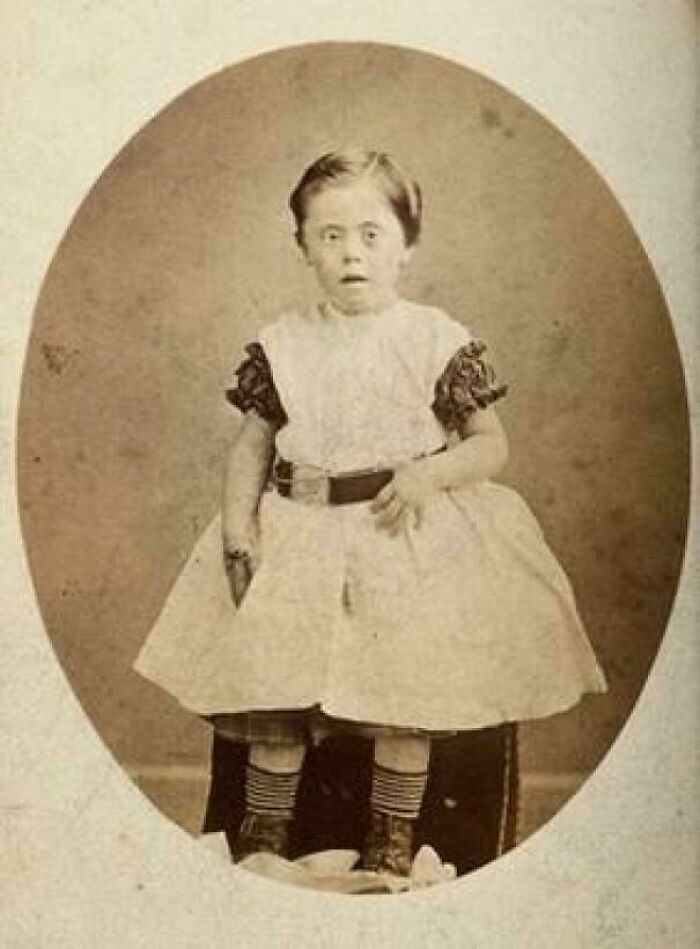 A Victorian-Era Girl With Down's Syndrome: Labels That Were Cringe, Late 1800s