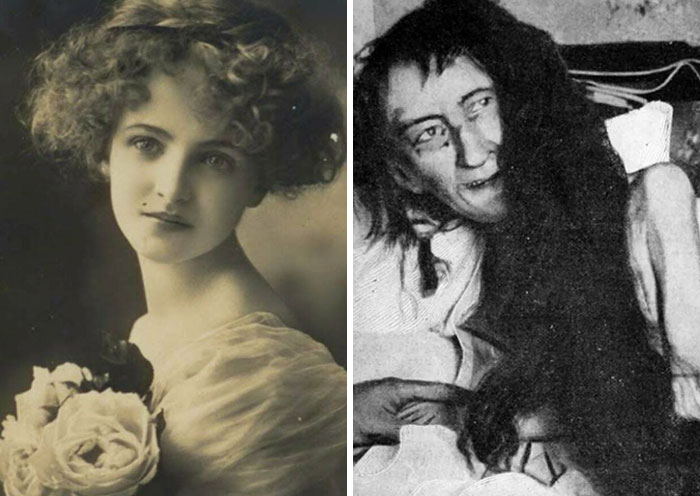 Woman Chained In Attic For 25 Years After Family Feud, Found In 1901