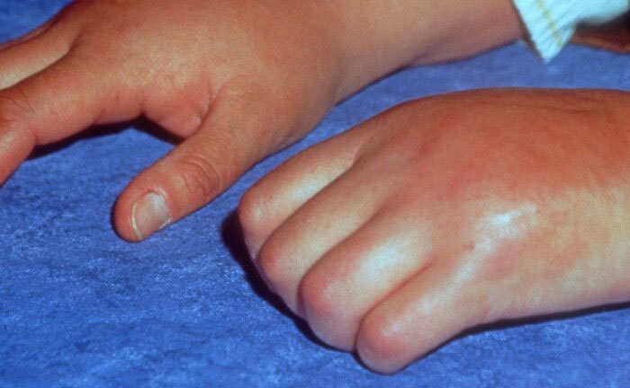 Wait, They Actually Ranked The Worst Diseases?!