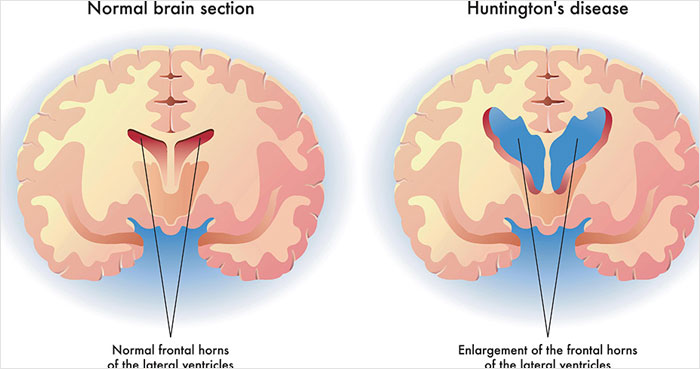 Wait, They Actually Ranked The Worst Diseases?!