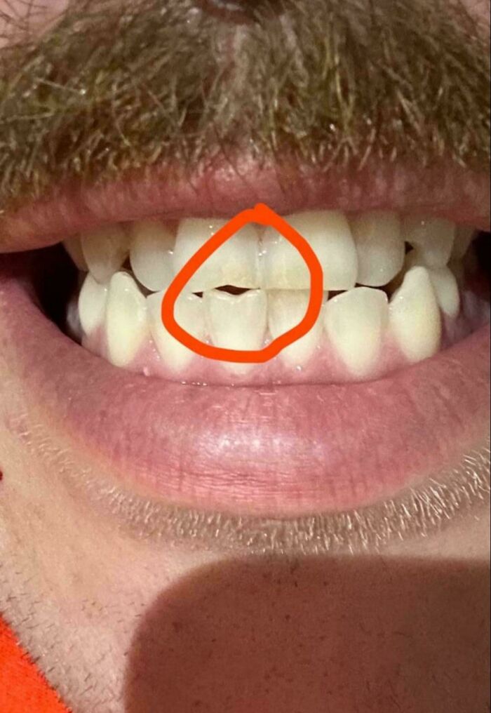 65 Everyday Things That Got Totally Loved (And Worn Out) Over The Years