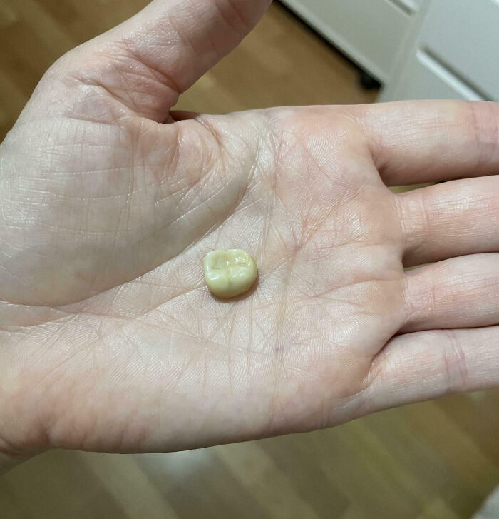 Oops! 50 Expensive Fails That'll Make Your Wallet Scream