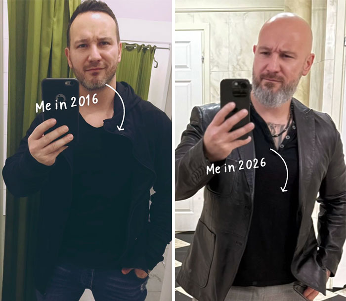 65 Then-and-Now Pics That Make You Go "Wait, Is That Even The Same Person?"